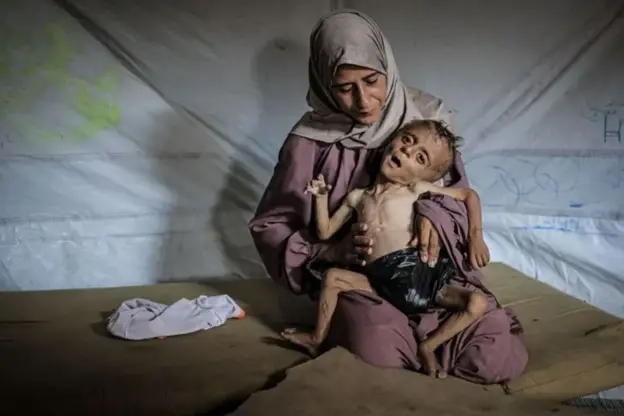 gaza_child_shocking_2.jpg
